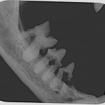 intraorální snímek pravé dolní čelisti - rozpad zubů