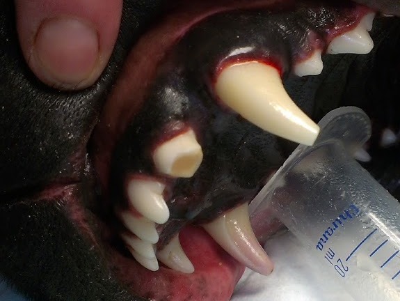 zlomený zub po ošetření