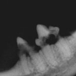 postižené zuby resorpčními lézemi