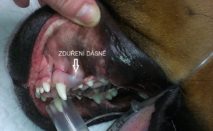 zubní cysta - zduření dásně